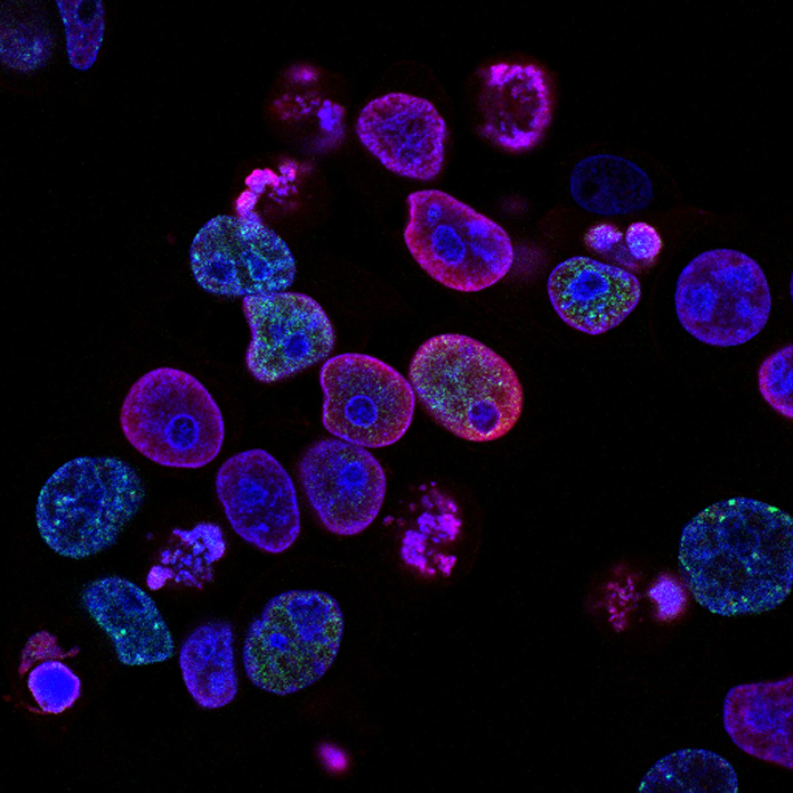 Aurora Science chiude il suo secondo investimento nelle biotecnologie